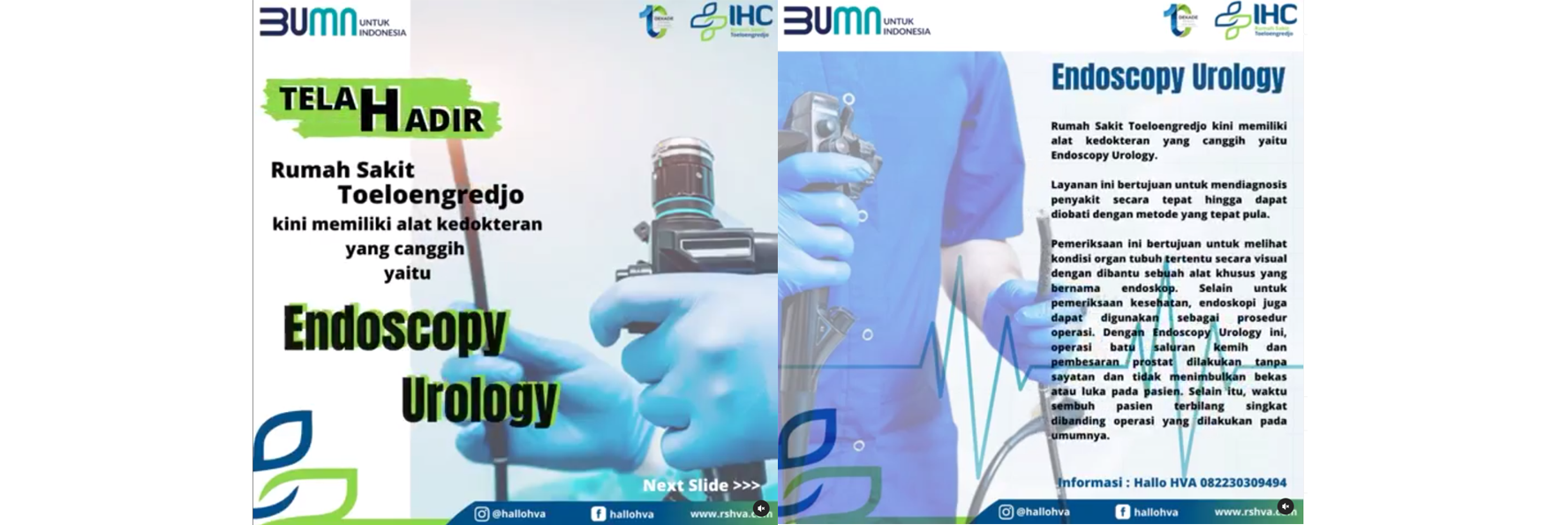 Endoscopy Urologi