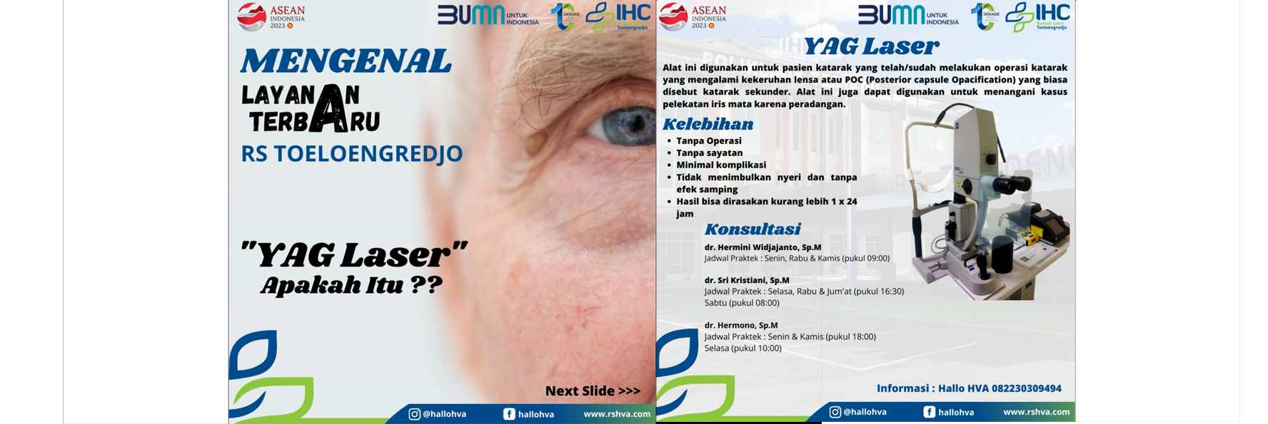 YAG Laser